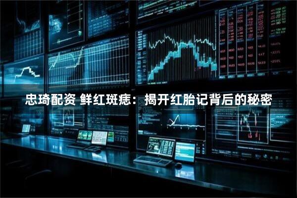 忠琦配资 鲜红斑痣：揭开红胎记背后的秘密